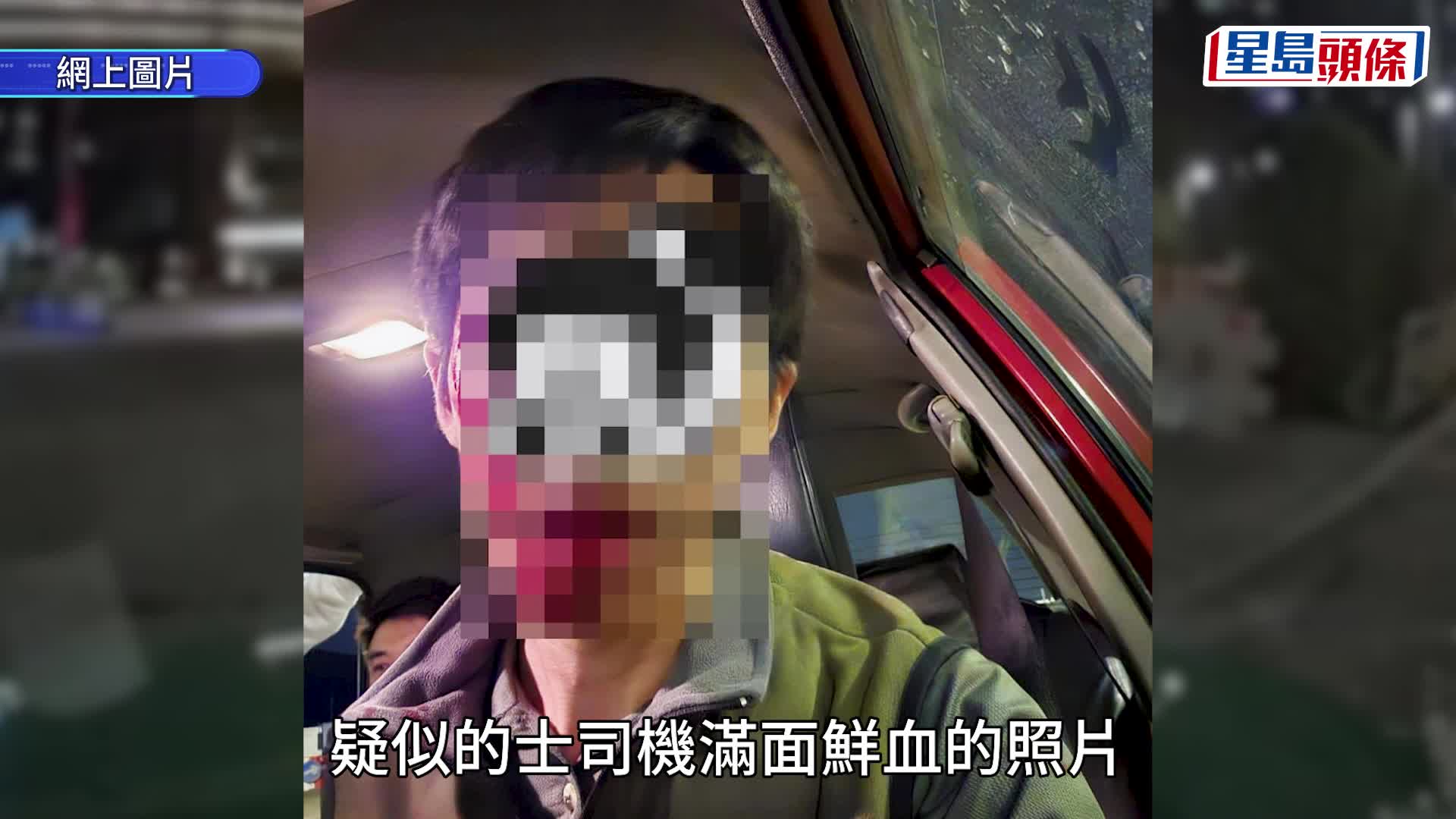 粉嶺的士司機疑發晦氣遭乘客毆傷 業界促盡快強制裝車Cam 一原因令新界的士陷「弱勢」