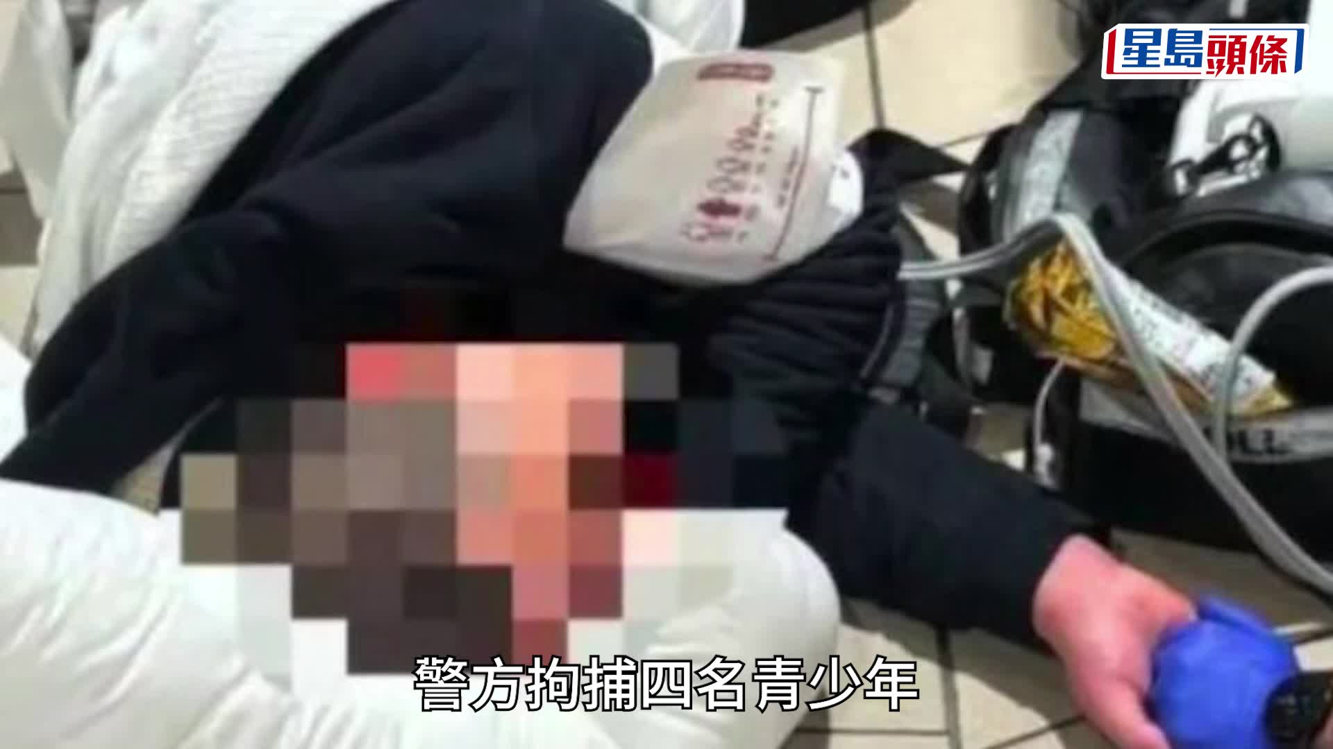 33中國男留學生在澳洲遭約20名青少年無故毆至重傷。新京報