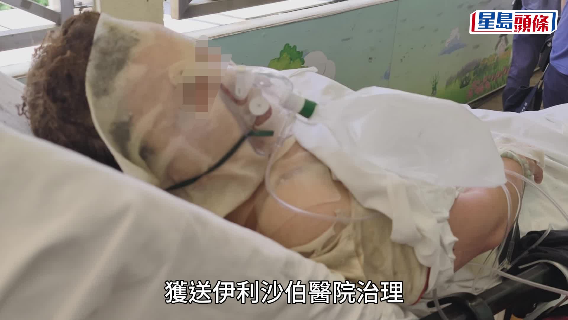 觀塘藍田邨單位煤氣爐蒸蕃薯時爆炸 女住戶4成燒傷送院