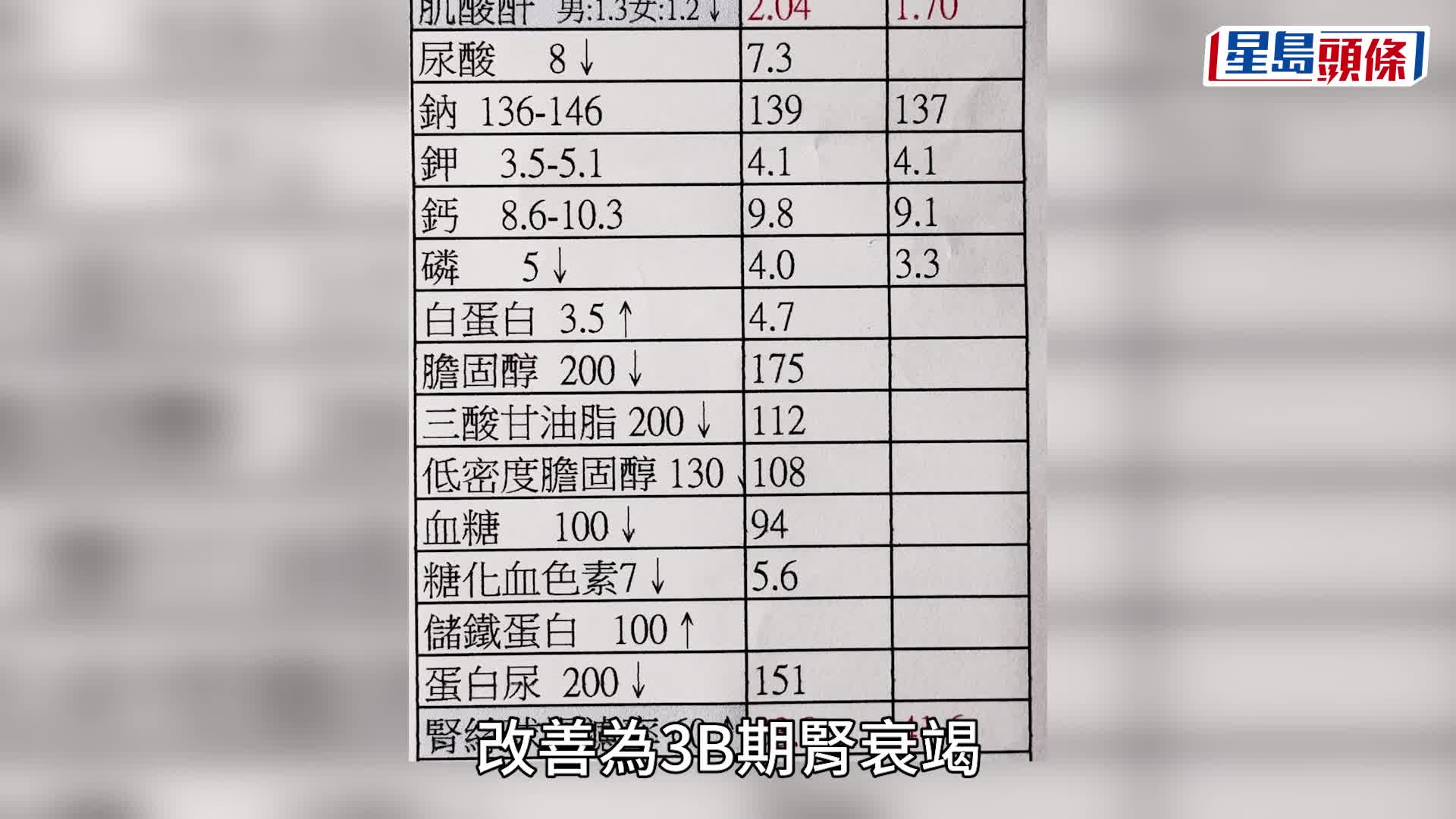 57歲王喜驚傳患急性腎衰竭 去年12月曾貼入院相 醫生一度指需終身洗腎