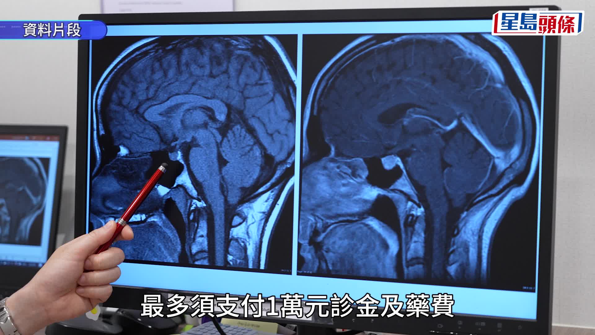 公院今起配藥每次最多24周 癌症病人稱理解：無必要一次過開很多藥