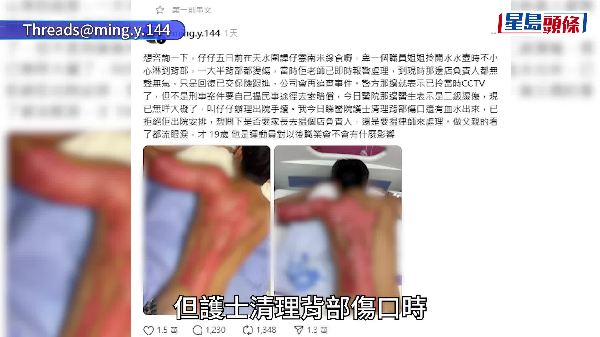 天水圍譚仔倒瀉熱水壺 19歲青年背部二級燒傷 譚仔：致深切歉意及慰問